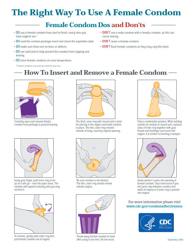 Female Condom Anal